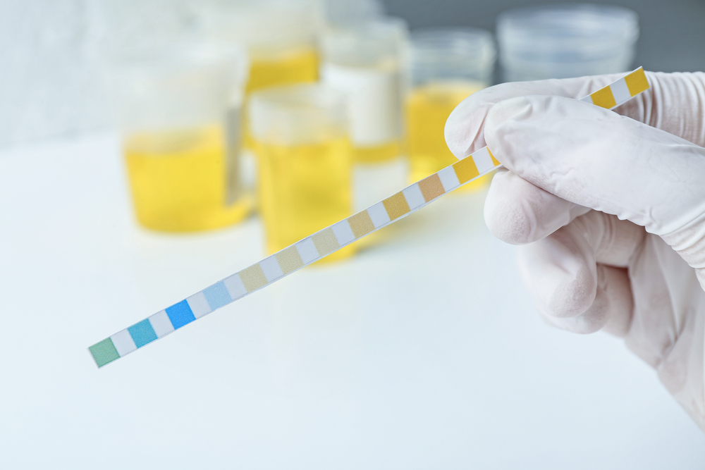 Should I Be Concerned About Urine Therapy?